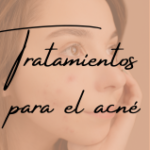 Tratamientos para el acne