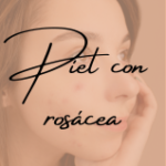 Tratamientos para piel con rosacea